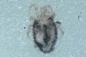 Close-up microscopic image of a tiny mite with a rounded body and visible legs.